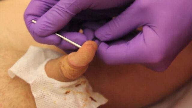 Stabbed twice in the penis (double apadravya piercing)- the modified world-hd