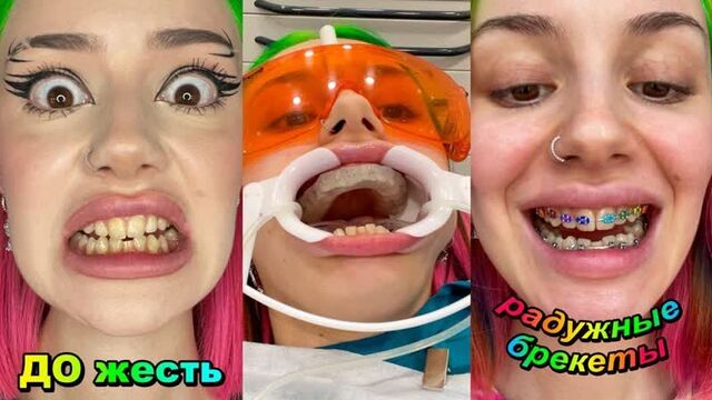 [daria graph] я поставила брекеты *очень больно!*