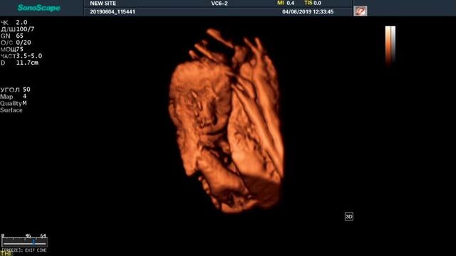 Video by клиника легамед | чебоксары