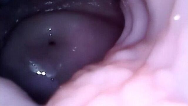 Камера внутри вагины / camera inside vagina women