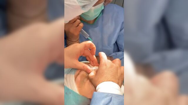 Даша корейка операция на нос 