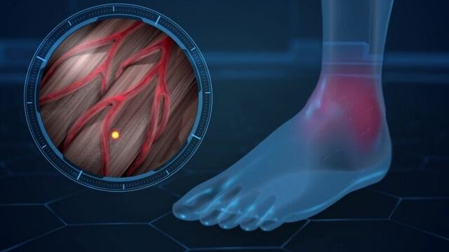 Мидокалм: уколы и таблетки, от чего помогает