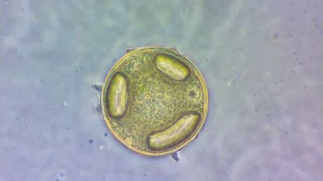 Раковинная амеба рода arcella. фазовый контраст. 1000х