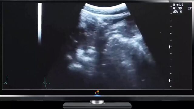 Daddy ultrasound deep fuck