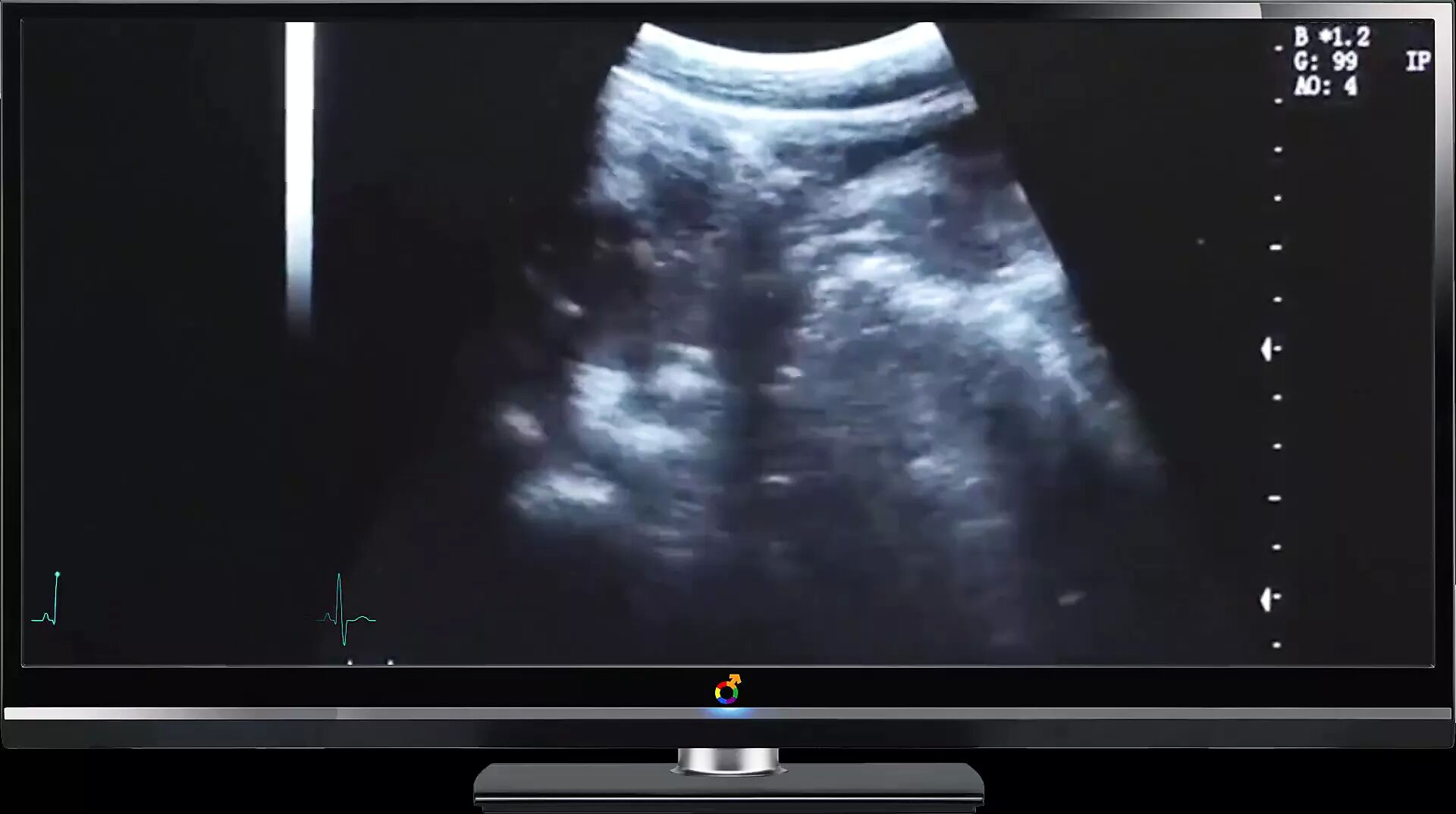 Ultrasound Sex Porn - Daddy ultrasound deep fuck â€” porn video online