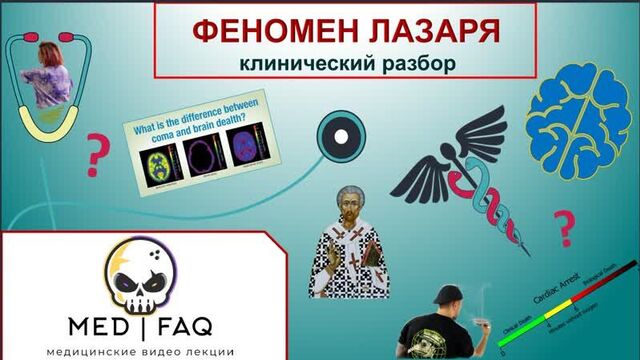 Клинический разбор - синдром лазаря